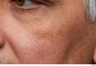 HD Face Skin Reuben Panjaitan cheek face skin pores skin…